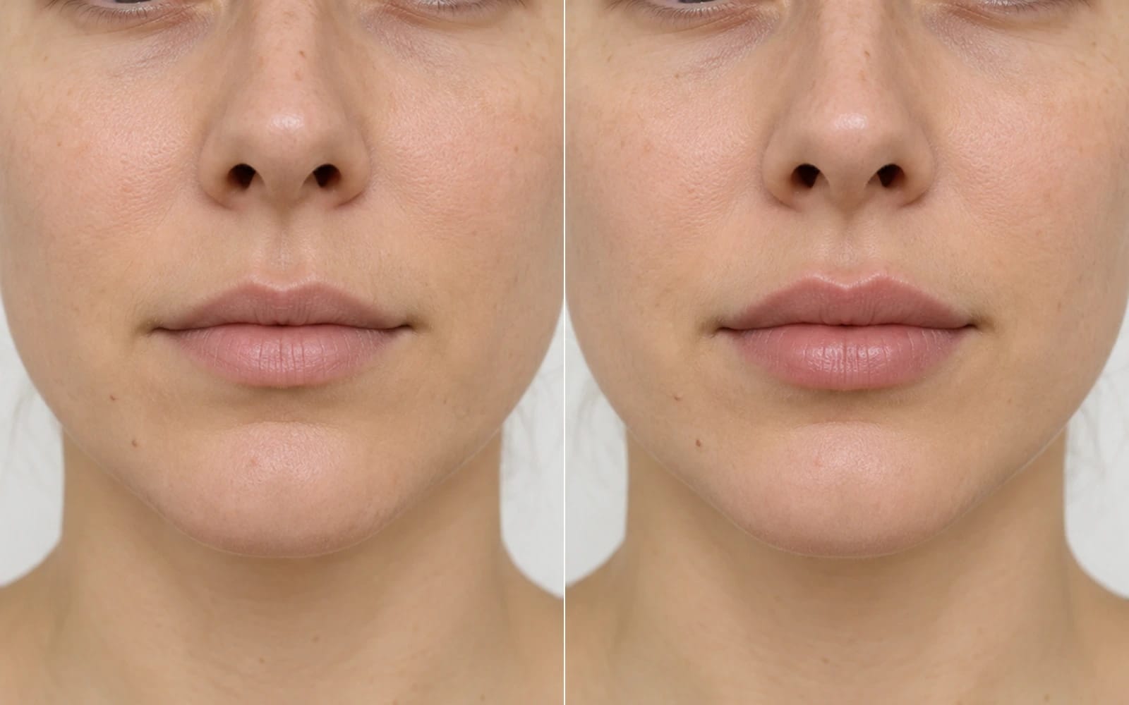 Case 2: before and after