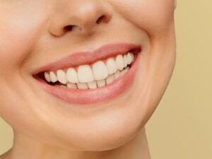 Sonrisa asimétrica portada - Rejuvelook